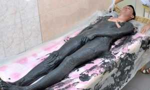 Болезнь Бехтерева у мужчин – лечение и диагностика