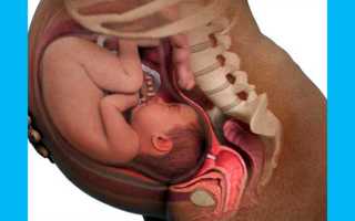 Можно ли забеременеть с кистой яичника