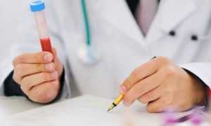 Анемия у беременных — причины, степени и виды, диагностика, методы лечения и возможные последствия