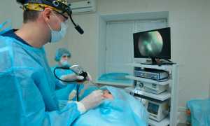 Аденотомия у детей и взрослых