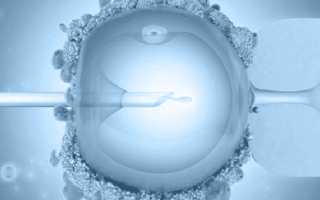ЭКО после внематочной беременности: показания и противопоказания