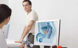 Перекрут яичка: симптомы и лечение