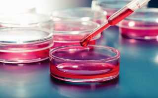 Норма Д-димера при беременности