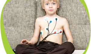 Экстрасистолия у детей и подростков: причины, как распознать и лечить