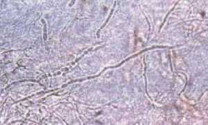 Что такое мицелий грибка и как с ним бороться