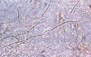 Что такое мицелий грибка и как с ним бороться