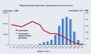 Мерцательная аритмия: причины, симптомы, класификация; прогнозы, чем опасно заболевание