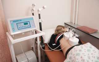 Как помогает электрофорез при миоме матки?