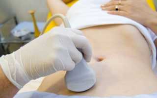 Полип в шейке матки — причины возникновения, симптомы, методы лечения