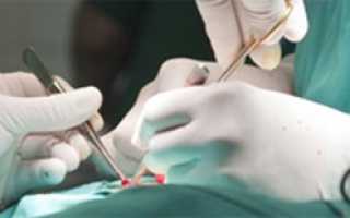 Асептический некроз головки тазобедренного сустава