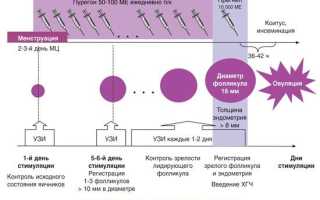 Способы стимуляции овуляции