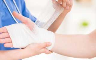 Химический ожог — степени, оказание первой помощи и лечение