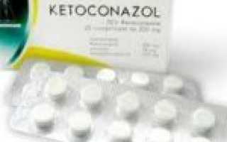 Что такое гипертрофический онихомикоз и как его лечить