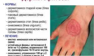 Способы заражения различными видами грибков