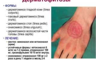 Способы заражения различными видами грибков