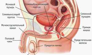 Мужское бесплодие: причины, симптомы и лечение