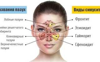 8 симптомов синусита у детей и взрослого