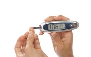 Взаимосвязаны ли между собой инсулинорезистентность и бесплодие?