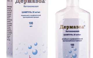 Эффективное применение шампуня Дермазол