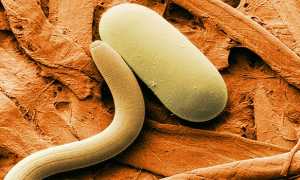 Анализ кала на паразитов