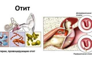 Симптомы отита у детей — основные признаки и виды заболевания