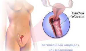 Причины молочницы после овуляции