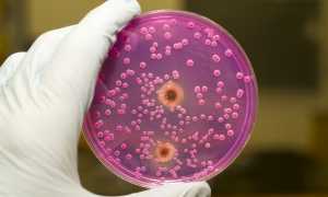 Пимафуцин при беременности. Свечи и таблетки. Инструкция по применению.