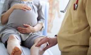 Боль в ногах при беременности