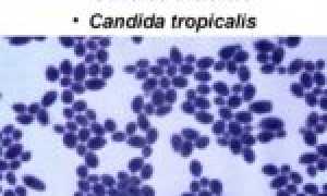 Препарат Орунгамин для эффективного лечения грибковых заболеваний