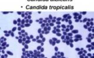 Препарат Орунгамин для эффективного лечения грибковых заболеваний