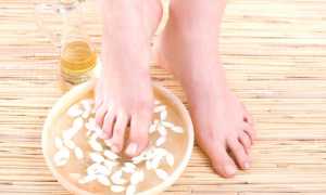 Трещины на пятках — лечение в домашних условиях эффективными средствами и методами