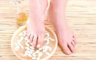 Трещины на пятках — лечение в домашних условиях эффективными средствами и методами