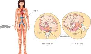 Почему нельзя беременной спать на спине