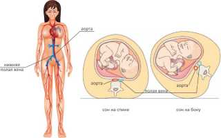 Почему нельзя беременной спать на спине