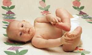 Дисплазия тазобедренных суставов