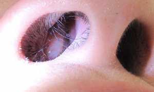 Причины гайморита у детей и взрослых — первые проявления