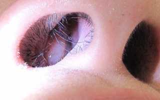 Причины гайморита у детей и взрослых — первые проявления