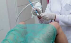 Особенности взятия мазка на гонорею