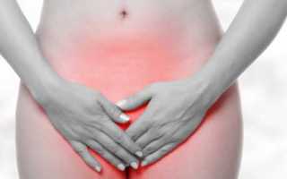 Молочница в период овуляции: симптомы и лечение