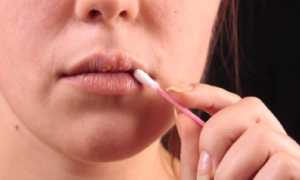 Супрессивная терапия герпеса