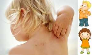 Атаракс: показания к применению, инструкция