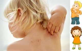 Атаракс: показания к применению, инструкция