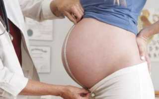 Схватки перед родами: сколько длятся, признаки и ощущения