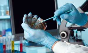 Углеводы в кале: расшифровка анализа