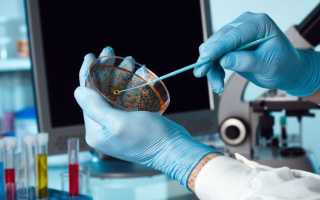 Углеводы в кале: расшифровка анализа