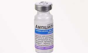 Инфекционный артрит — возбудители болезни, симптомы, диагностика