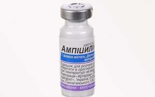 Инфекционный артрит — возбудители болезни, симптомы, диагностика