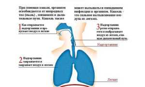 Чем лечить кашель при беременности