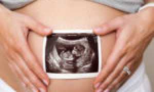 Как лечить молочницу на сосках у кормящих мамочек