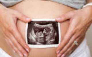 Как лечить молочницу на сосках у кормящих мамочек